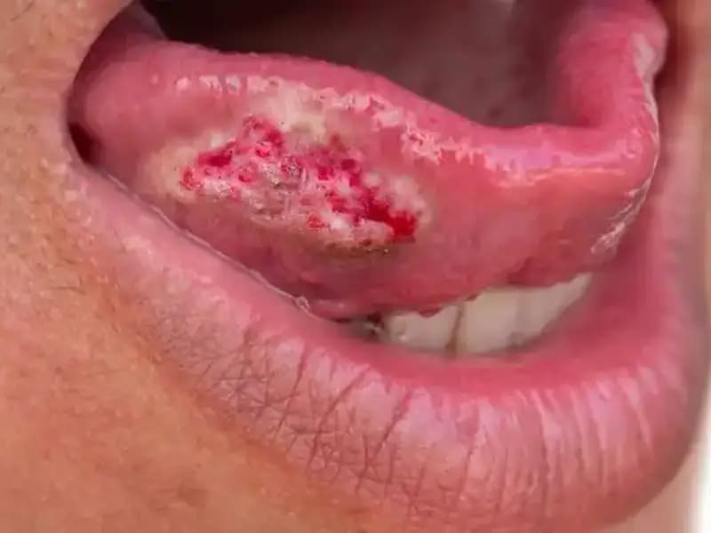 36 Yaşındaki Kadının Migreni Gerçekten Kanser Belirtisi Olabilir!