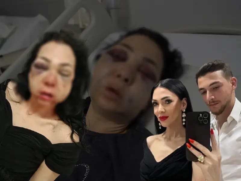 Kocaeli'de Bayramda Kafede Dehşet: Anne Oğlunun Gözünde Dövüldü