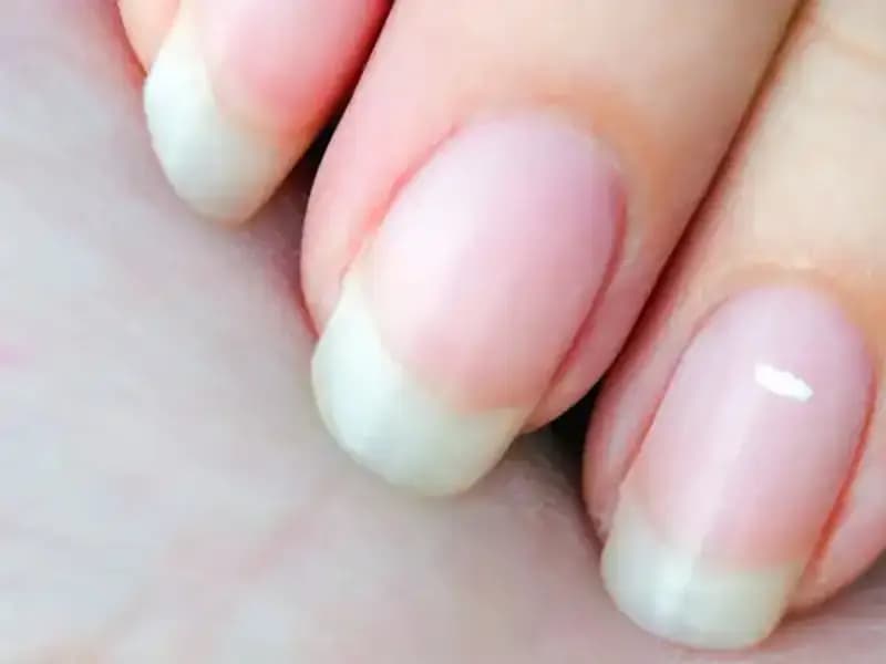 Tırnaklarınız Geleceğinizi Mi Anlatıyor? Uzmanların Şaşırtıcı Yorumları