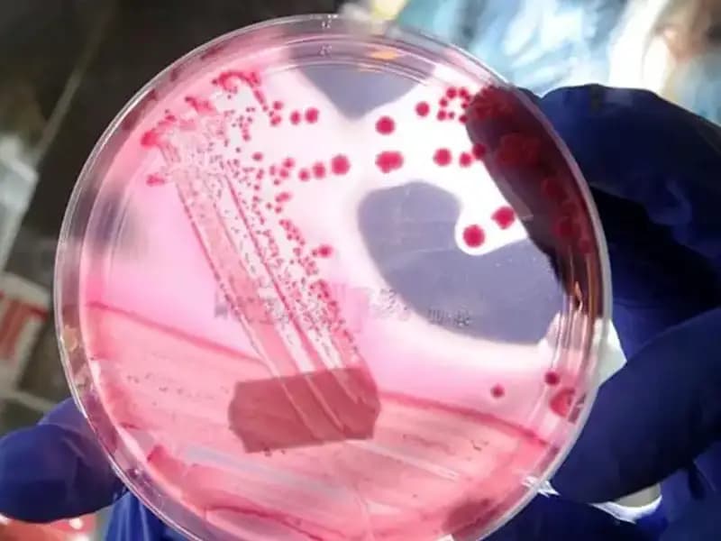 AP2A1 Proteini: Yaşlanmayı Unutturan Keşif ve Beklentiler