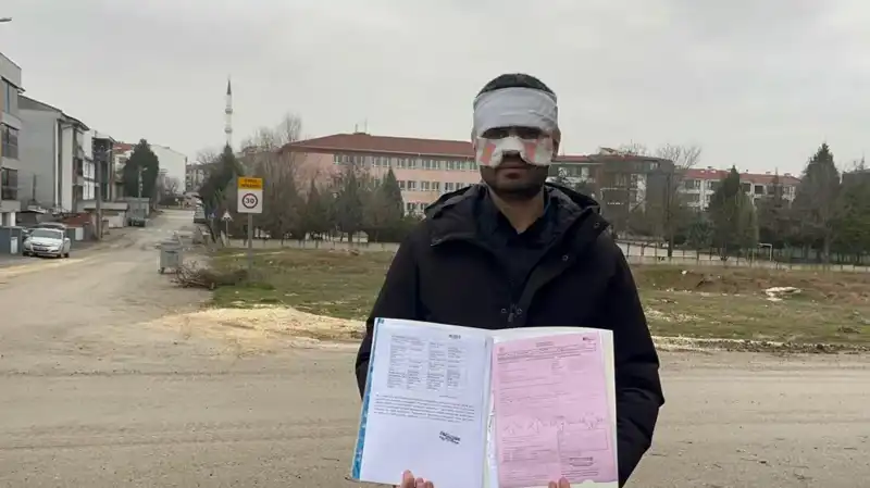 Öğretmen, Öğretmene Fena Yandı: Sıcak Çayla Saldırı!