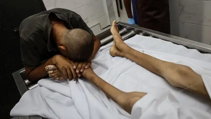 Gazze'deki Çocuk Açlığı: Bir Hayat Daha Kayboldu
